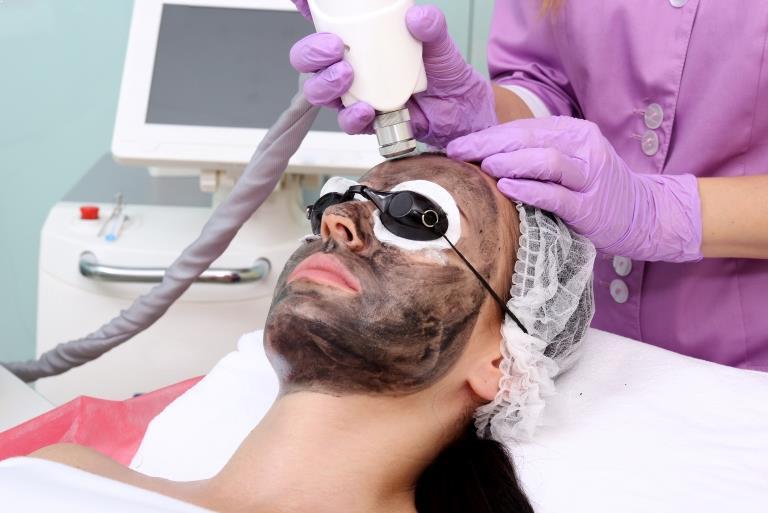 Hollywood Carbon Peeling