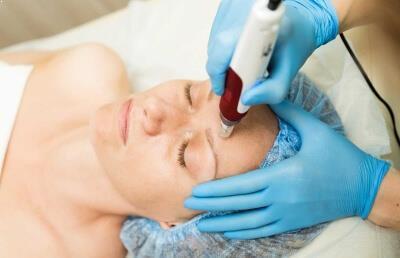 Micro-Needling